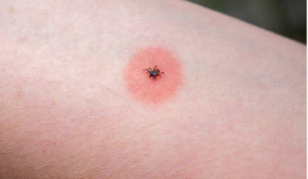 insectenbeten