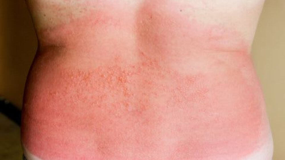 Warmtebultjes 